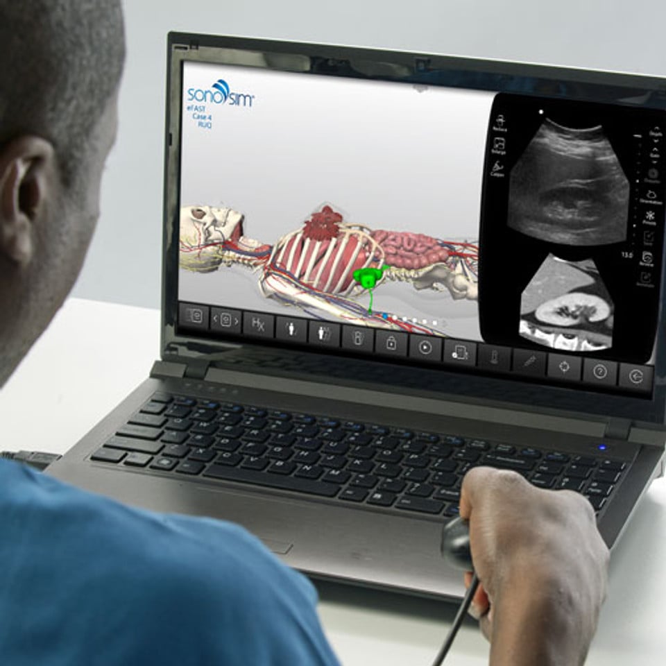 eFAST Clinical Ultrasound Training | SonoSim